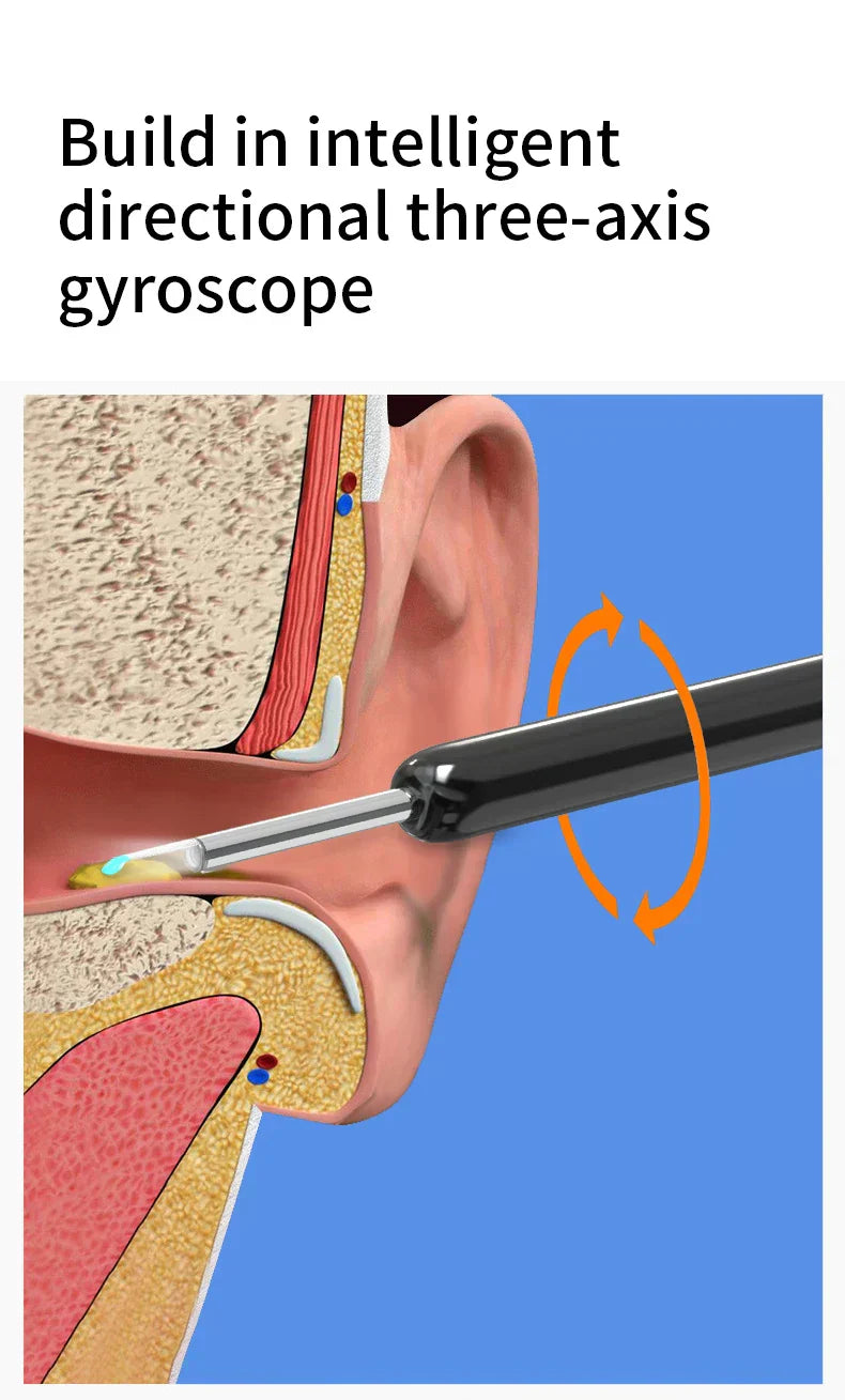 Smart Visual Ear Cleaner HD Otoscope