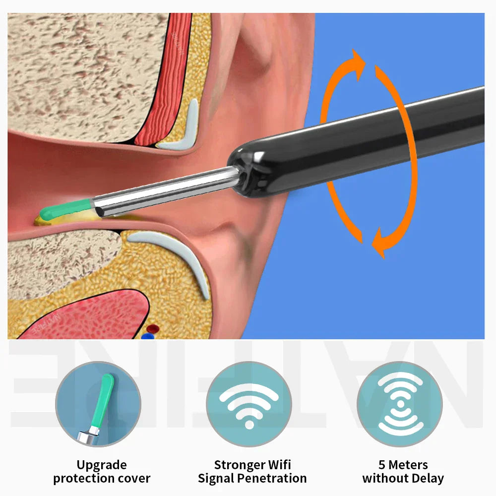 Smart HD Visual Ear Cleaner