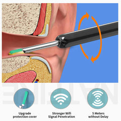 Smart HD Visual Ear Cleaner